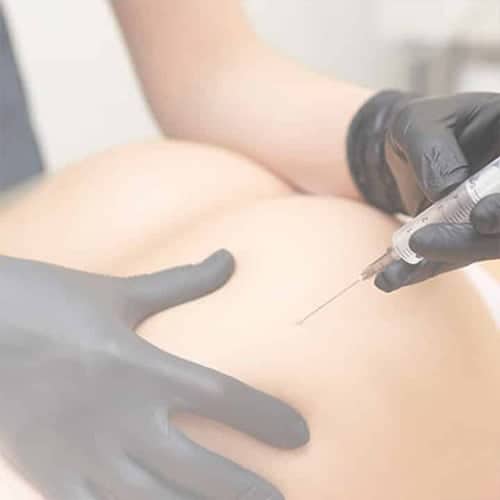 augmentation-fesses-acide-hyaluronique-hyacorp-paris-medecin-esthetique-paris-dr-levy-jerry-chirurgien-esthetique-paris