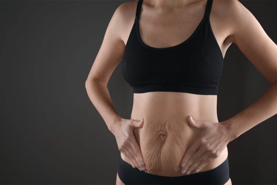 mommy makeover prix chirurgie mammaire et ventre apres grossesse chirurgie plastique paris docteur jerry levy chirurgien plasticien paris