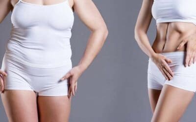 Le BodyTite pour traiter le relâchement de la peau sans cicatrices