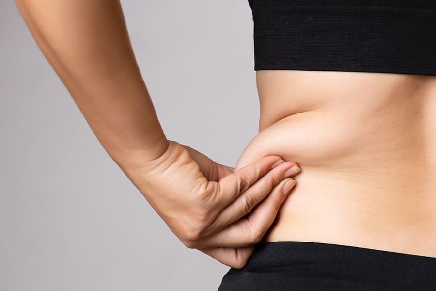 bodytite ventre avant apres chirugie esthetique corps docteur jerry levy chirurgien esthetique paris