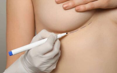 Zoom sur l&rsquo;augmentation mammaire composite