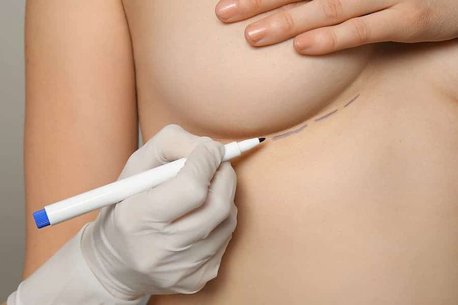 augmentation mammaire composite chirurgie mammaire paris dr jerry levy chirurgien esthetique