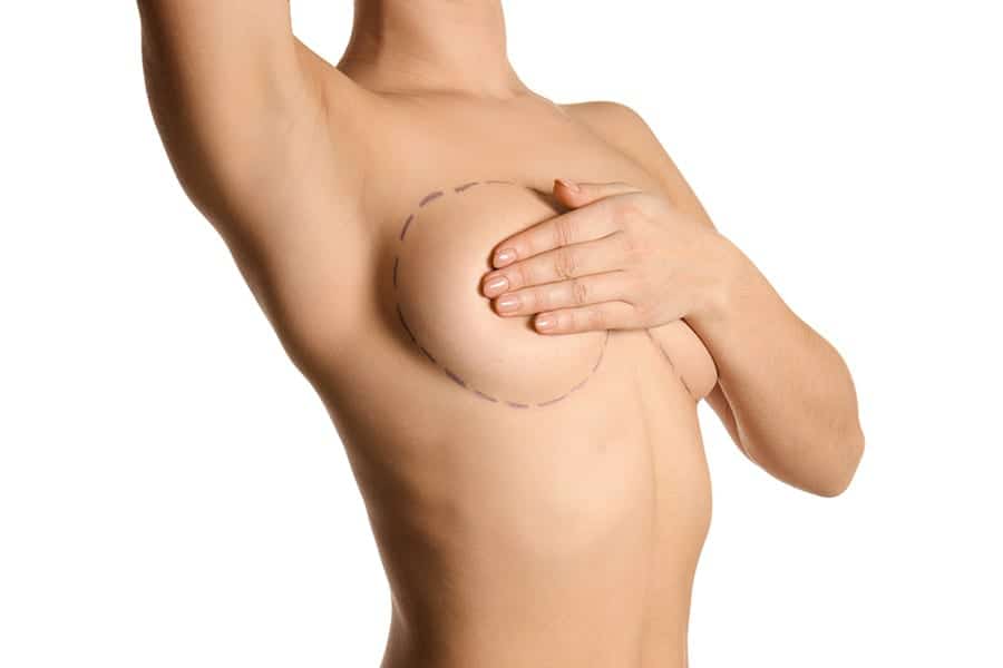 lipofilling mammaire apres masectomie chirurgie seins docteur jerry levy chirurgien esthetique paris