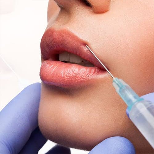 acide-hyaluronique-augmentation-levres-medecin-esthetique-paris-dr-levy-jerry-chirurgien-esthetique-paris