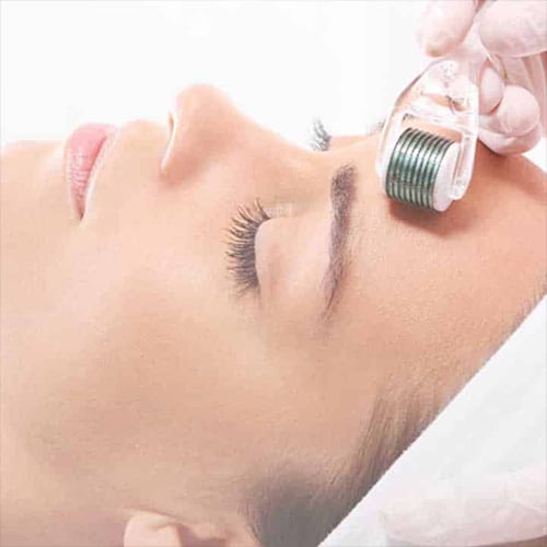 mesolift-visage-avant-apres-medecin-esthetique-paris-dr-levy-jerry-chirurgien-esthetique-paris