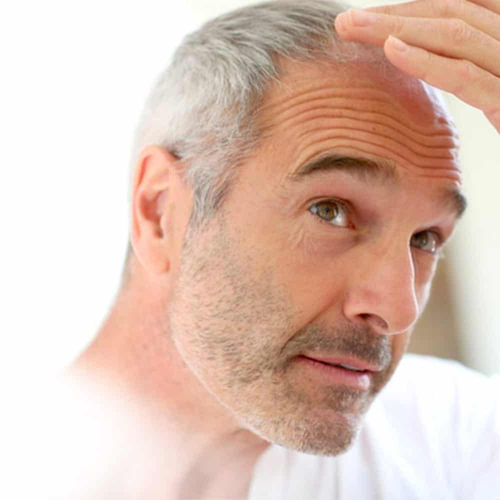 greffe de cheveux fue sans raser sans rasage chirurgie esthethique paris docteur jerry levy chirurgien esthetique paris