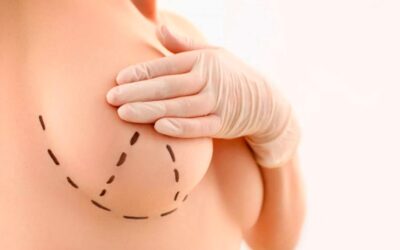 Quel est le tarif d&rsquo;un lipofilling mammaire ?