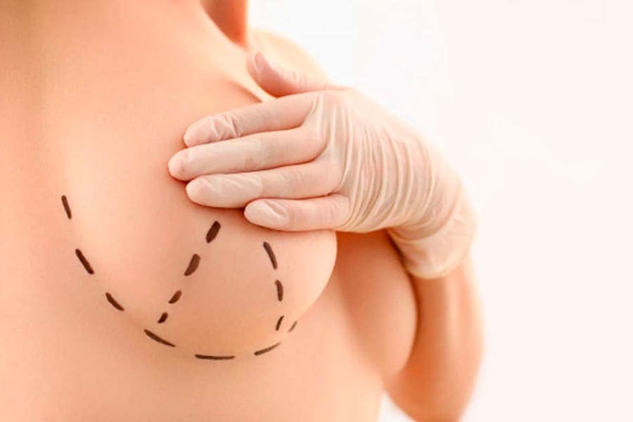 prix lipofilling mammaire docteur jerry levy chirurgien esthetique specialiste chirurgie esthetique paris