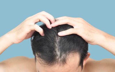 Comment se fait la repousse des cheveux après greffe ?