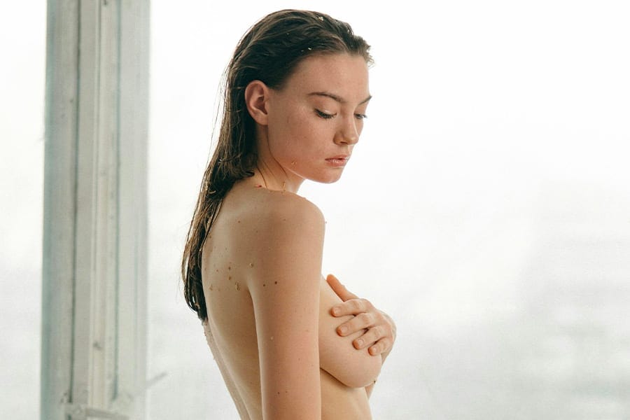 evolution cicatrice lifting mammaire docteur jerry levy chirurgien esthetique specialiste augmentation mammaire paris