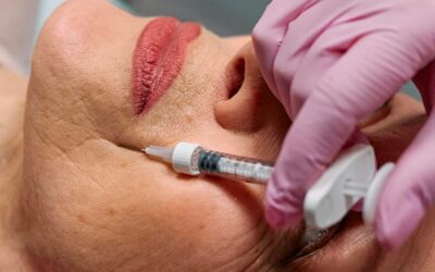 Injection toxine botulique et douleur : qu’en penser ?