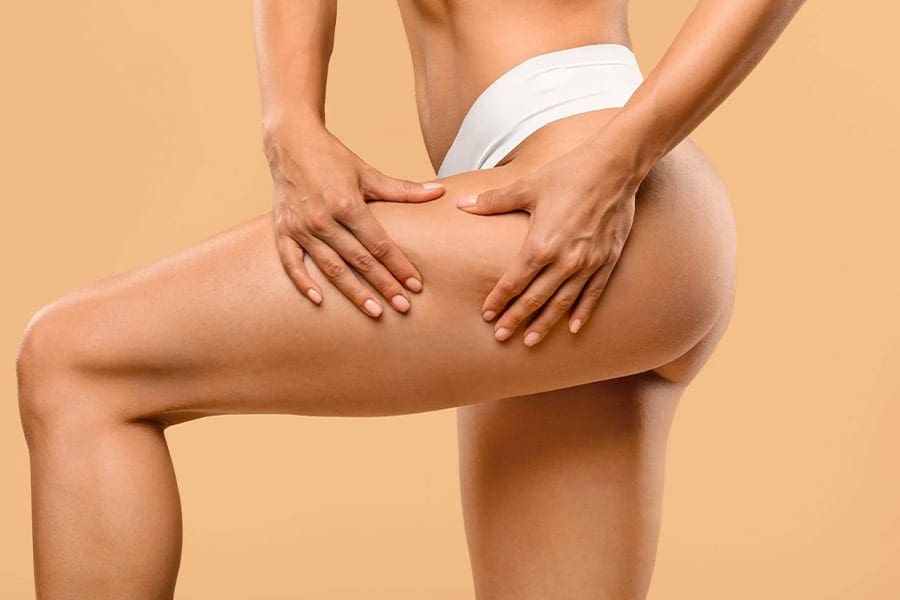 renuvion j-plasma cuisses docteur jerry levy chirurgien esthetique specialiste chirurgie de la silhouette paris