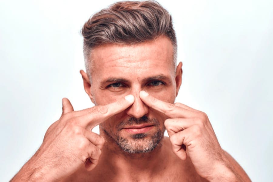 rhinoplastie homme avant apres docteur jerry levy chirurgien esthetique specialiste medecine esthetique paris