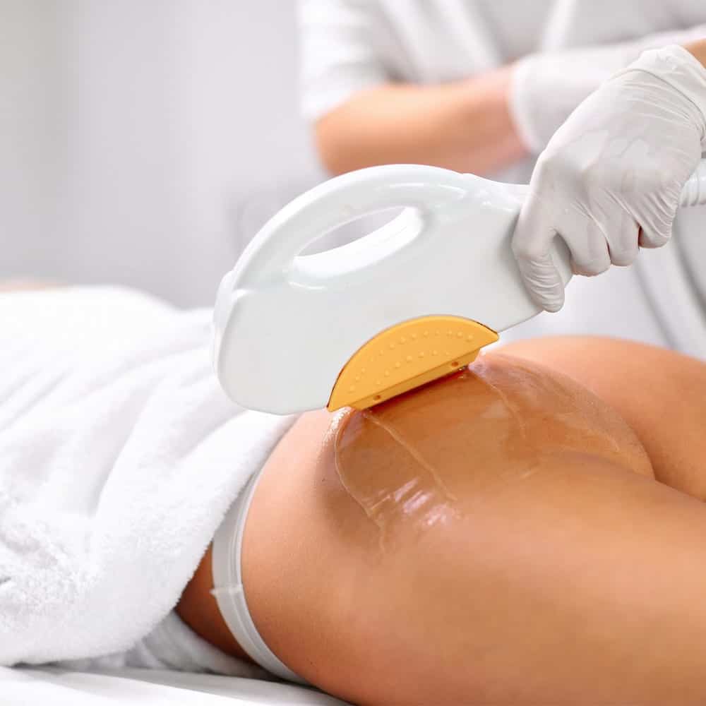 epilation definitive sillon inter fessier medecin esthetique paris docteur levy jerry chirurgien esthetique paris