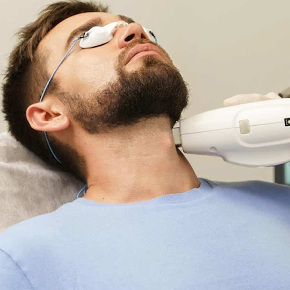 epilation laser barbe avant apres medecin esthetique docteur levy jerry chirurgien esthetique paris