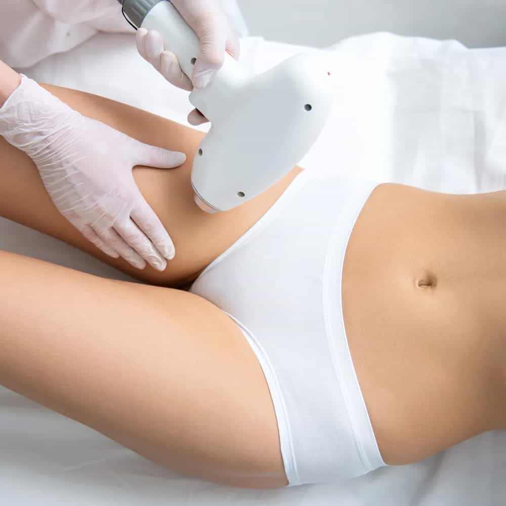 epilation laser maillot echancre medecin esthetique paris docteur levy jerry chirurgien esthetique paris