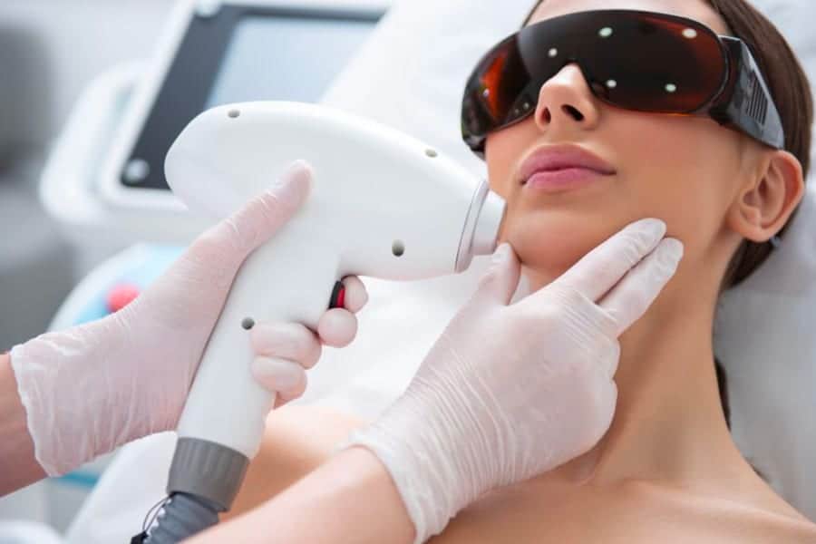 epilation laser visage avant apres medecin esthetique dr levy jerry chirurgien esthetique paris
