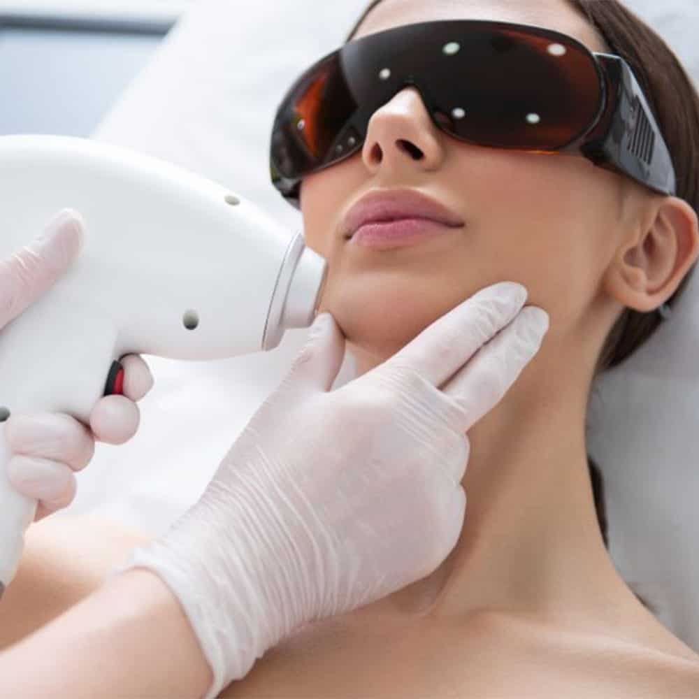 epilation laser visage risques medecin esthetique docteur levy jerry chirurgien esthetique paris